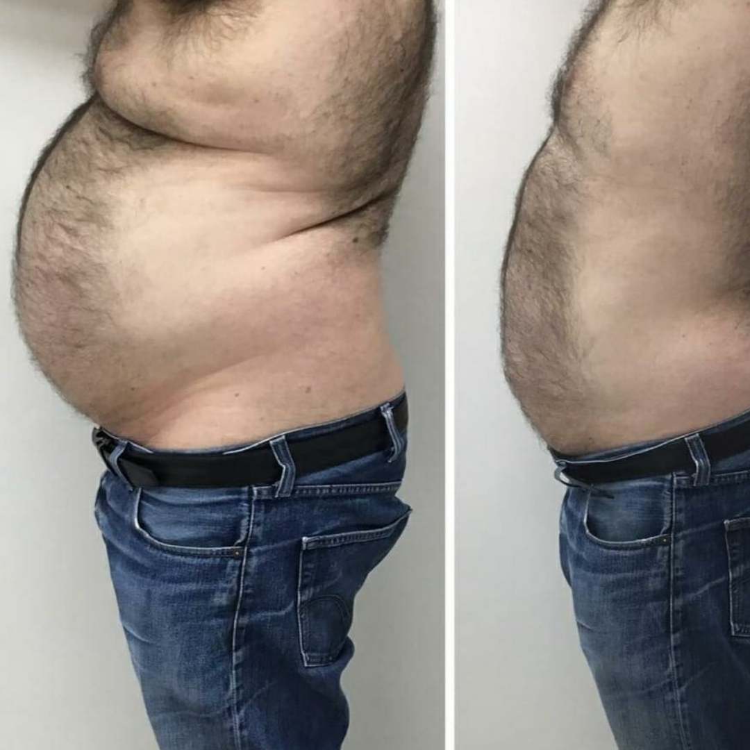 Aesthetiq TURBO FIT - NEW FORMULA